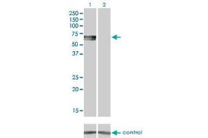 Western blot analysis of BMPR1B over-expressed 293 cell line, cotransfected with BMPR1B Validated Chimera RNAi (Lane 2) or non-transfected control (Lane 1). (BMPR1B anticorps  (AA 14-502))