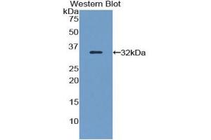 WB of Protein Standard: different control antibodies against Highly purified E. (FLNB Kit ELISA)