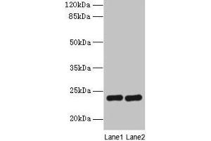 Western blot All lanes: RD3 antibody at 0. (RD3 anticorps  (AA 1-195))
