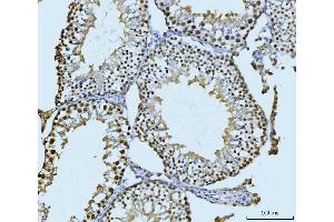 IHC analysis of SBNO1 using anti-SBNO1 antibody (ABIN7601710). (SBNO1 anticorps  (AA 43-1303))