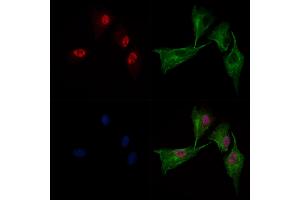 ABIN6262179 and ABIN6269054 staining  cells by IF/ICC. (HDAC3 anticorps  (C-Term))