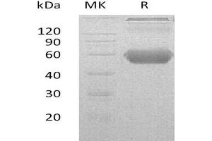 Western Blotting (WB) image for Tumor Necrosis Factor Receptor Superfamily, Member 18 (TNFRSF18) (Active) protein (His tag,Fc Tag) (ABIN7320534)