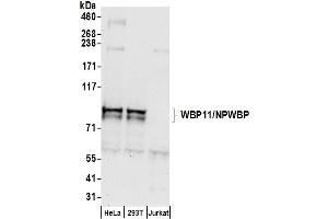 Western Blotting (WB) image for anti-WW Domain Binding Protein 11 (WBP11) (AA 200-250) antibody (ABIN7450904)