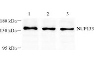 Western blot analysis of NUP133 (ABIN7074909) at dilution of 1: 1000,Lane 1: K562 cell lysate,Lane 2: 293 cell lysate,Lane 3: A375 cell lysate (NUP133 anticorps)