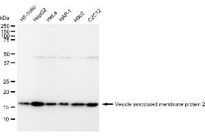 anti-Vesicle-Associated Membrane Protein 2 (Synaptobrevin 2) (VAMP2) antibody