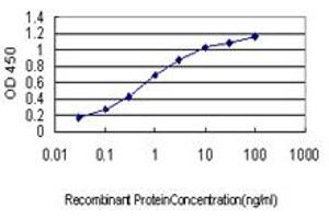 Detection limit for recombinant GST tagged CDC42BPA is approximately 0. (CDC42BPA anticorps  (AA 551-650))