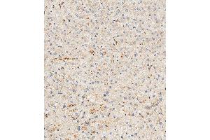 Immunohistochemical analysis of paraffin-embedded Human liver tissue using (ABIN390596 and ABIN2840914) performed on the Leica® BOND RXm.