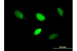 Immunofluorescence of purified MaxPab antibody to T on HeLa cell. (T Brachyury Protein (AA 1-377) anticorps)