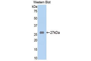 Western Blotting (WB) image for anti-alpha-2-Macroglobulin (A2M) (AA 818-1048) antibody (ABIN1857845) (alpha 2 Macroglobulin anticorps  (AA 818-1048))