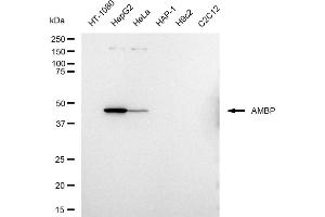 Western blotting analysis using AMBP antibody (ABIN7797583).