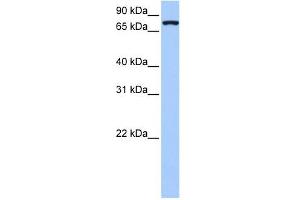 NLGN4X antibody used at 1 ug/ml to detect target protein. (Neuroligin 4 anticorps  (Middle Region))