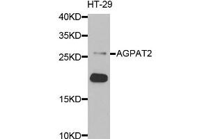 Western blot analysis of extracts of HT-29 cells, using AGPAT2 antibody. (AGPAT2 anticorps)