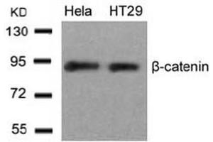 Image no. 3 for anti-Catenin (Cadherin-Associated Protein), beta 1, 88kDa (CTNNB1) (Ser33) antibody (ABIN197445) (CTNNB1 anticorps  (Ser33))