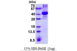 Image no. 1 for Amnionless (AMN) (AA 20-357) protein (His tag) (ABIN6387097)