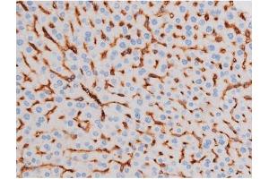 ABIN6267484 at 1/200 staining Mouse liver tissue sections by IHC-P.