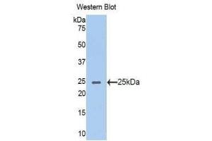 Western Blotting (WB) image for anti-Acetylcholinesterase (AChE) (AA 367-549) antibody (ABIN1857863)