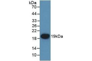 Detection of Recombinant F7, Mouse using Polyclonal Antibody to Coagulation Factor VII (F7) (Factor VII anticorps  (AA 42-169))