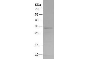 Western Blotting (WB) image for Peroxidasin Homolog (PXDN) (AA 595-702) protein (His-IF2DI Tag) (ABIN7124358)