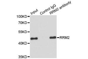Immunoprecipitation analysis of 200ug extracts of HeLa cells using 1ug RRM2 antibody.