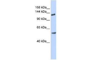 Western Blotting (WB) image for anti-Roundabout, Axon Guidance Receptor, Homolog 2 (ROBO2) antibody (ABIN2458930) (ROBO2 anticorps)