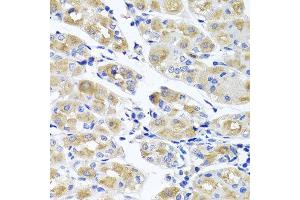 Immunohistochemistry of paraffin-embedded human gastric using SPATA4 antibody at dilution of 1:100 (x40 lens). (SPATA4 anticorps)