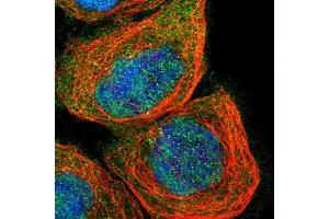 Immunofluorescent staining of human cell line A-431 shows localization to nucleoplasm, cytosol & centrosome.