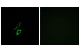 Immunofluorescence analysis of A549 cells, using FPR1 antibody. (FPR1 anticorps  (Internal Region))
