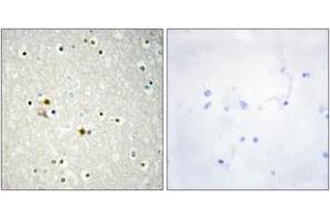 Immunohistochemistry analysis of paraffin-embedded human brain tissue, using DNL1 Antibody. (DNASE1 anticorps  (AA 111-160))