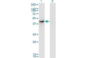 Western Blot analysis of SEPHS1 expression in transfected 293T cell line by SEPHS1 monoclonal antibody (M04), clone 3G3. (SEPHS1 anticorps  (AA 1-96))