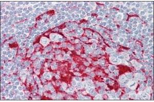 Human Tonsil: Formalin-Fixed, Paraffin-Embedded (FFPE)