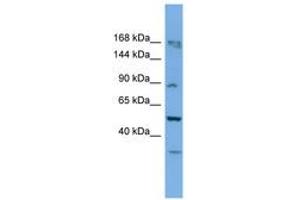 Image no. 1 for anti-TATA Box Binding Protein (TBP)-Associated Factor, RNA Polymerase I, C, 110kDa (TAF1C) (AA 701-750) antibody (ABIN6745644) (TAF1C anticorps  (AA 701-750))