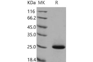 Western Blotting (WB) image for Lipocalin 2 (LCN2) (Active) protein (His tag) (ABIN7320459)