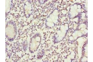 Immunohistochemistry of paraffin-embedded human small intestine tissue using ABIN7170406 at dilution of 1:100 (Sorting Nexin 7 anticorps  (AA 85-330))