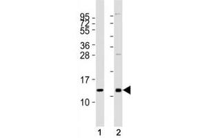 Western blot testing of CXCL12 antibody at 1:2000 dilution.