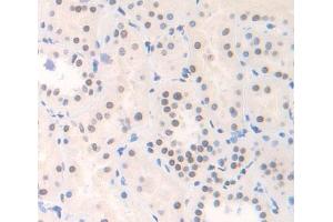 Used in DAB staining on fromalin fixed paraffin- embedded Kidney tissue