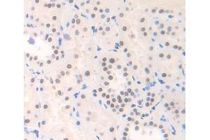 Used in DAB staining on fromalin fixed paraffin- embedded Kidney tissue (YAF2 anticorps  (AA 1-177))