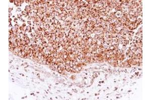 anti-2,4-Dienoyl CoA Reductase 1, Mitochondrial (DECR1) (AA 20-276) antibody