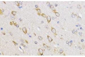 Immunohistochemistry of paraffin-embedded Rat brain using Bcl-2 Polyclonal Antibody at dilution of 1:100 (40x lens). (Bcl-2 anticorps)