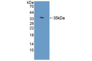 Figure. (LSP1 anticorps  (AA 127-331))