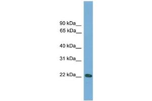 WB Suggested Anti-Rgs1 Antibody Titration:  0.