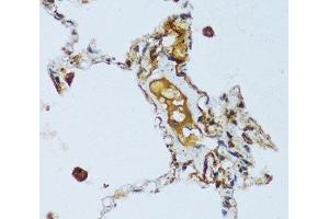 Immunohistochemistry of paraffin-embedded Human lung using C1QC Polyclonal Antibody at dilution of 1:100 (40x lens). (C1QC anticorps)