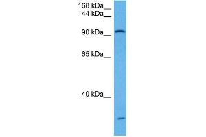 Host:  Rabbit  Target Name:  UBE3A  Sample Tissue:  Mouse Kidney  Antibody Dilution:  1ug/ml