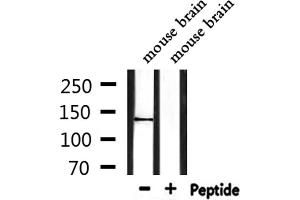Western blot analysis of extracts from mouse brain, using TRPS1 Antibody.