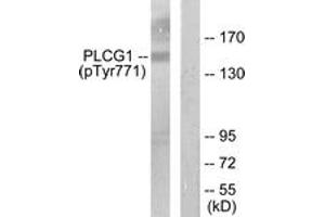 Western blot analysis of extracts from COS7 cells treated with EGF 200ng/ml 30', using PLCG1 (Phospho-Tyr771) Antibody. (Phospholipase C gamma 1 anticorps  (pTyr771))