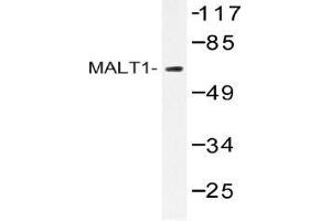 Western blot (WB) analysis of MALT1 antibody in extracts from HUVEC cells. (MALT1 anticorps)