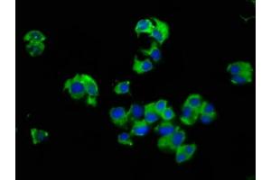 Immunofluorescence staining of MCF-7 cells with ABIN7175101 at 1:66, counter-stained with DAPI. (SLC14A1 anticorps  (AA 1-51))