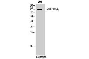 Western Blotting (WB) image for anti-PR (pSer294) antibody (ABIN3182419) (PR (pSer294) anticorps)