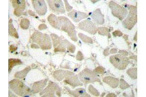 Immunohistochemical analysis of paraffin-embedded human heart tissue using COL5A1 polyclonal antibody . (COL5A1 anticorps)
