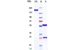 Anti-TIGIT Reference Antibody (tiragolumab) on SDS-PAGE under reducing (R) condition. (Recombinant TIGIT (Tiragolumab Biosimilar) anticorps)