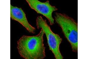 Fluorescent confocal image of HeLa cells stained with Tuberin antibody. (Tuberin anticorps  (AA 1776-1805))